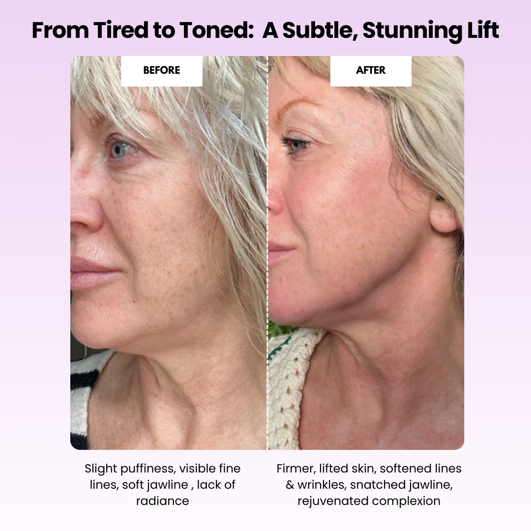 Nuvorya™ Glow Sculpt - Beauty Roller