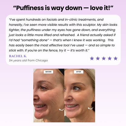 Nuvorya™ Glow Sculpt - Beauty Roller
